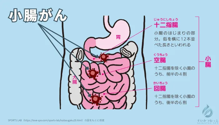 小腸がんとはどんな病気？