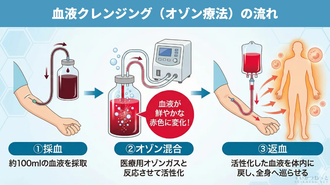 血液クレンジング(オゾン療法)の流れ